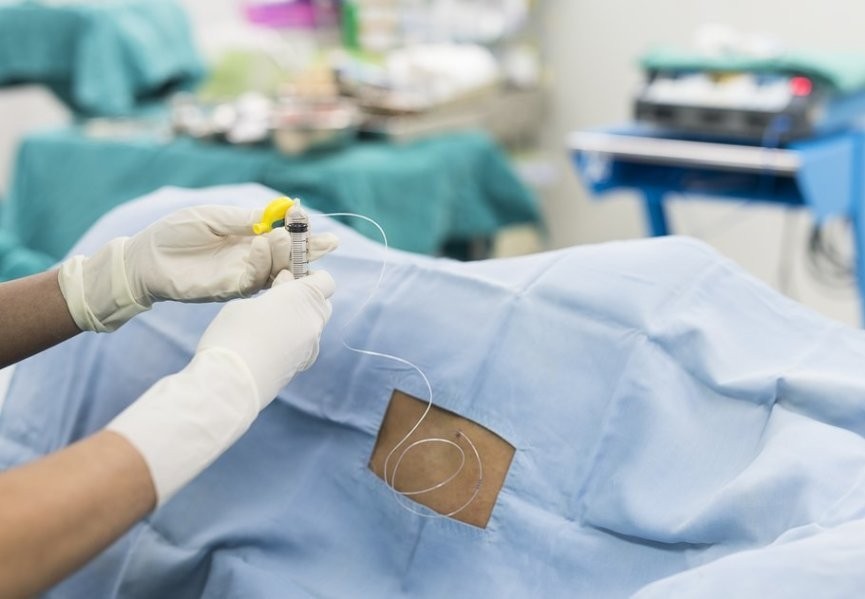 ТОП 10 питань про знеболення пологів