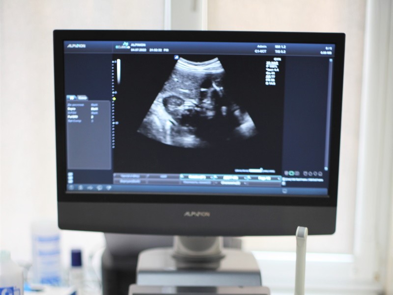 Найчастіші питання про УЗД для вагітних
