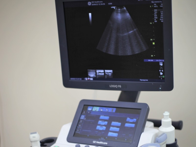 УЗД для вагітних в 3 триместрі