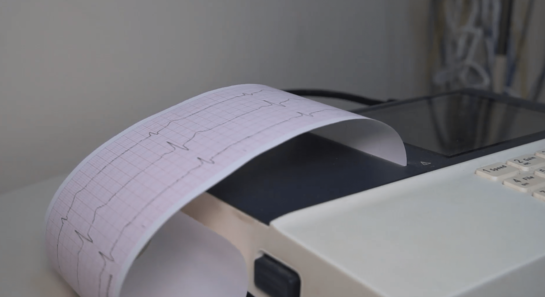 Кардіограма або ЕКГ