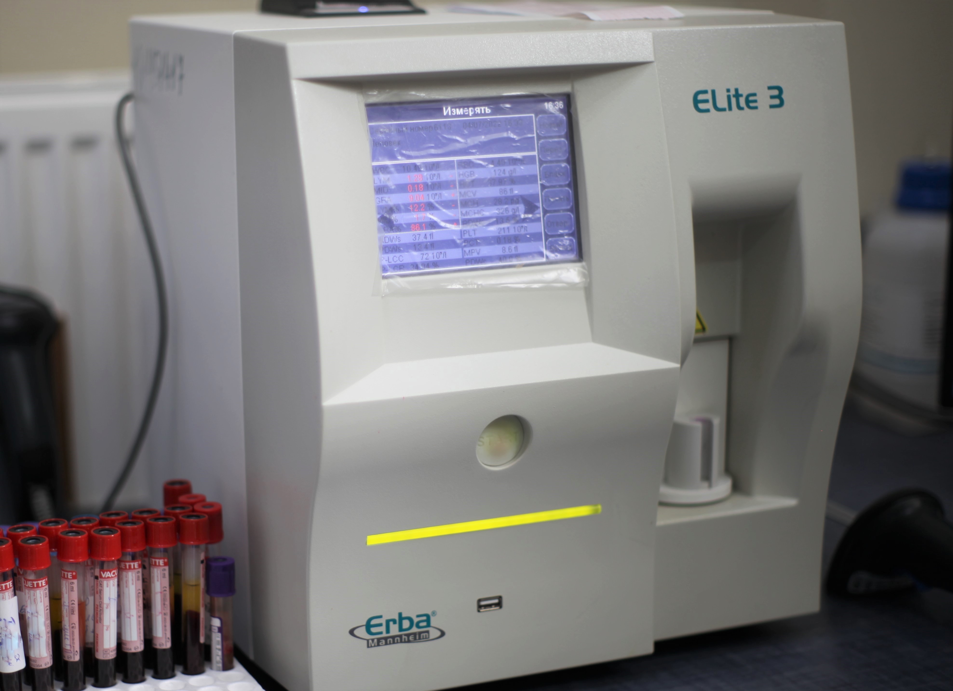 Гематологічний аналіз