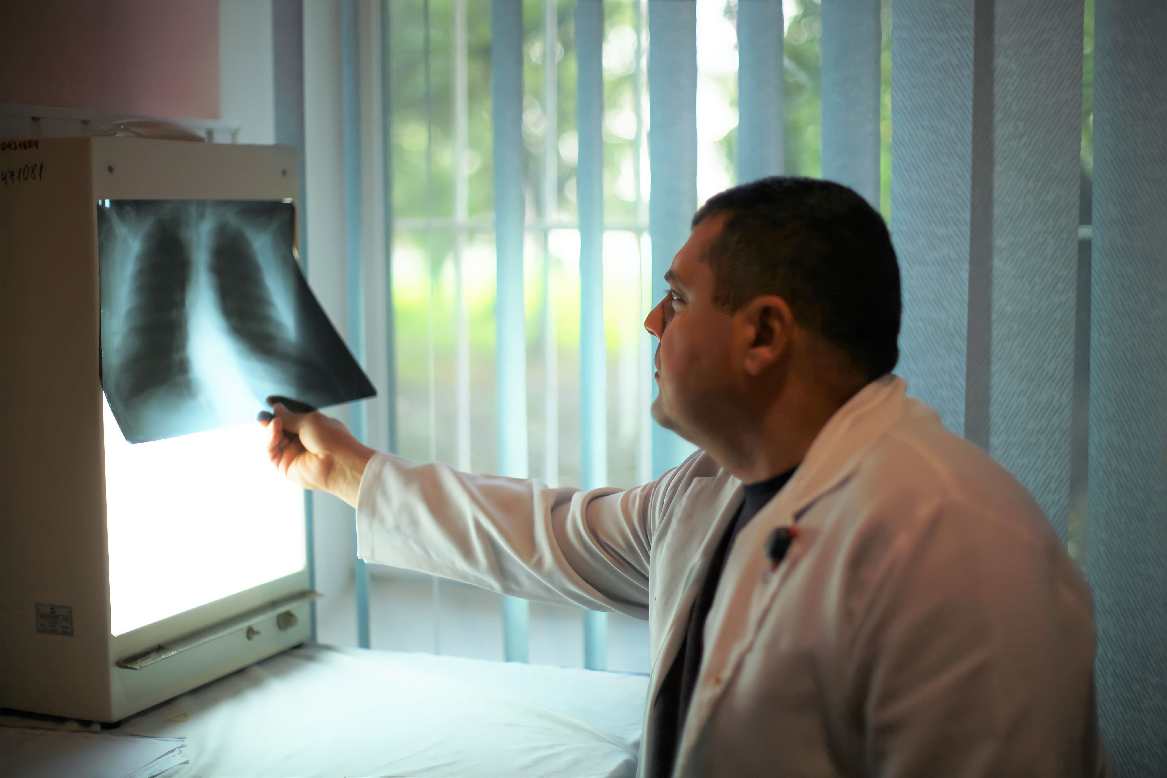 Рентгенографія органів грудної клітки (рентген легень)