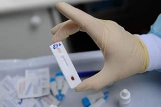 Чому так важливо пройти тестування на ВІЛ навіть клінічно здоровим людям?