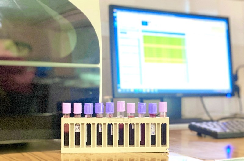 Аналіз на загальний холестерин: що це, для чого та кому здавати?