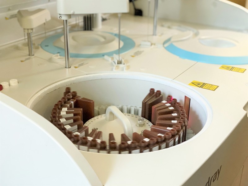 Ревмопроби