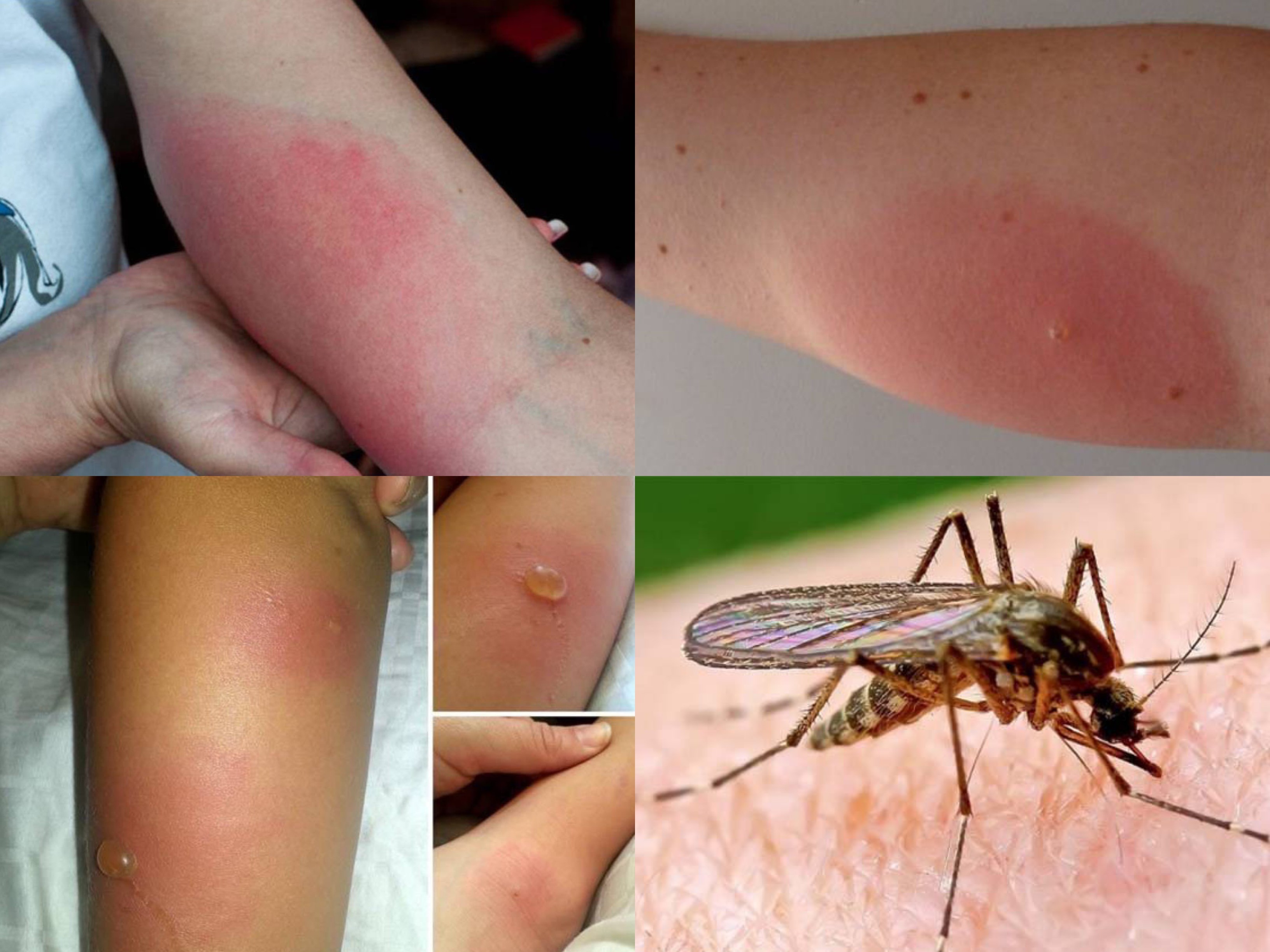 Допис від лікаря-дерматолога дитячого Олександри Буртин