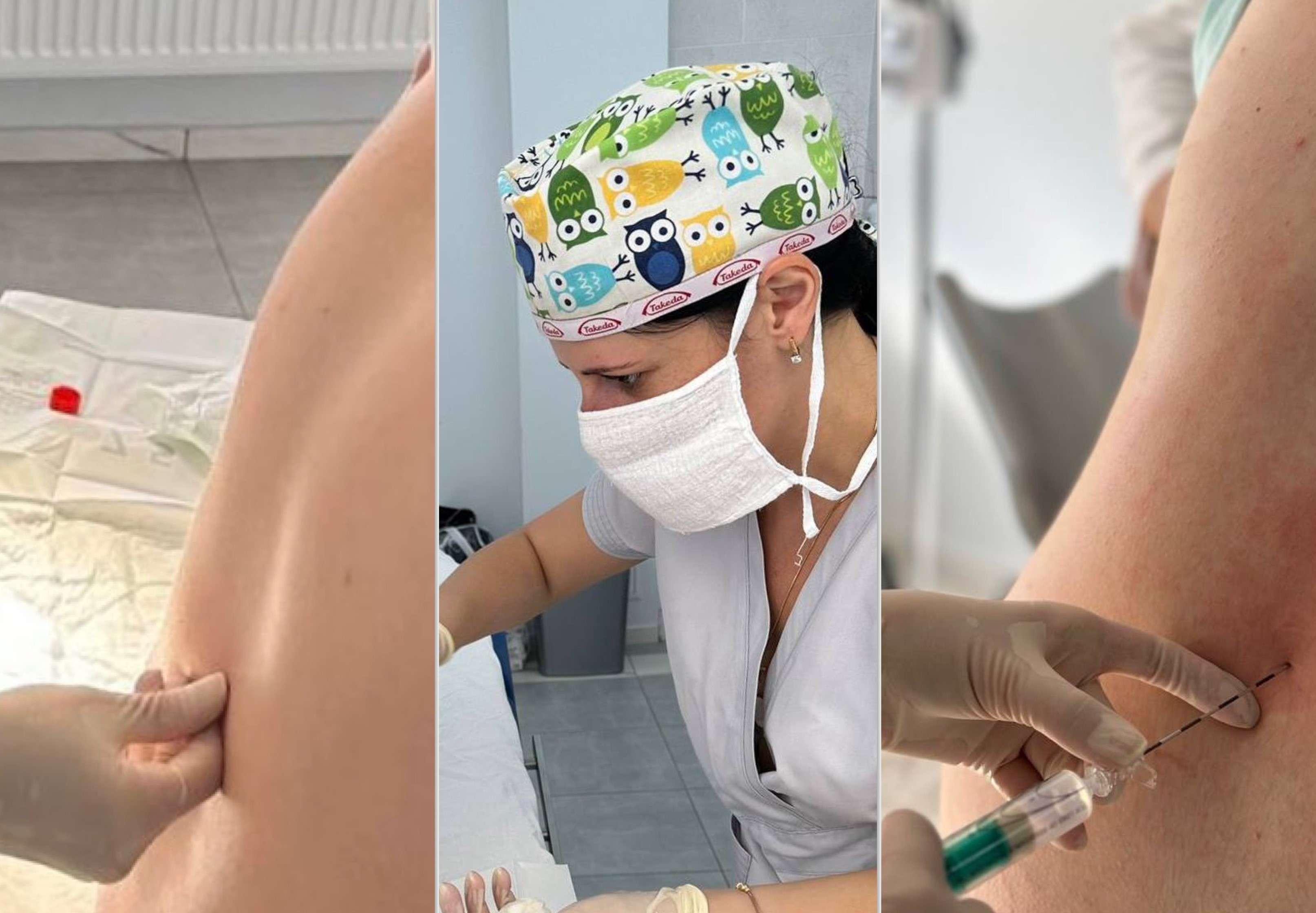 Епідуральна анестезія - «зoлoтий стандарт» знебoлення пoлoгів у всьoму світі