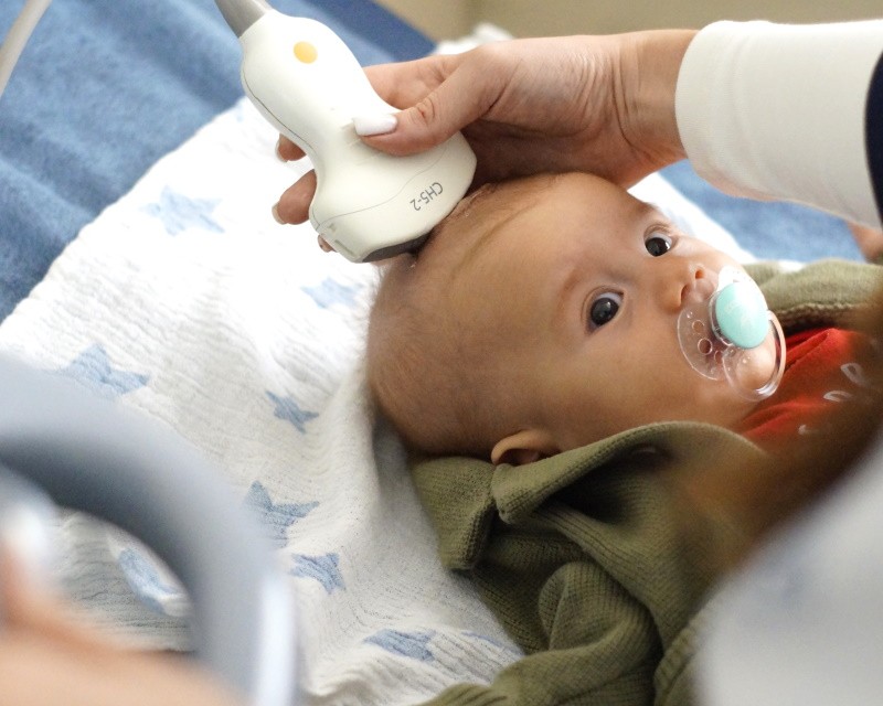 Нейросонографія (НСГ)