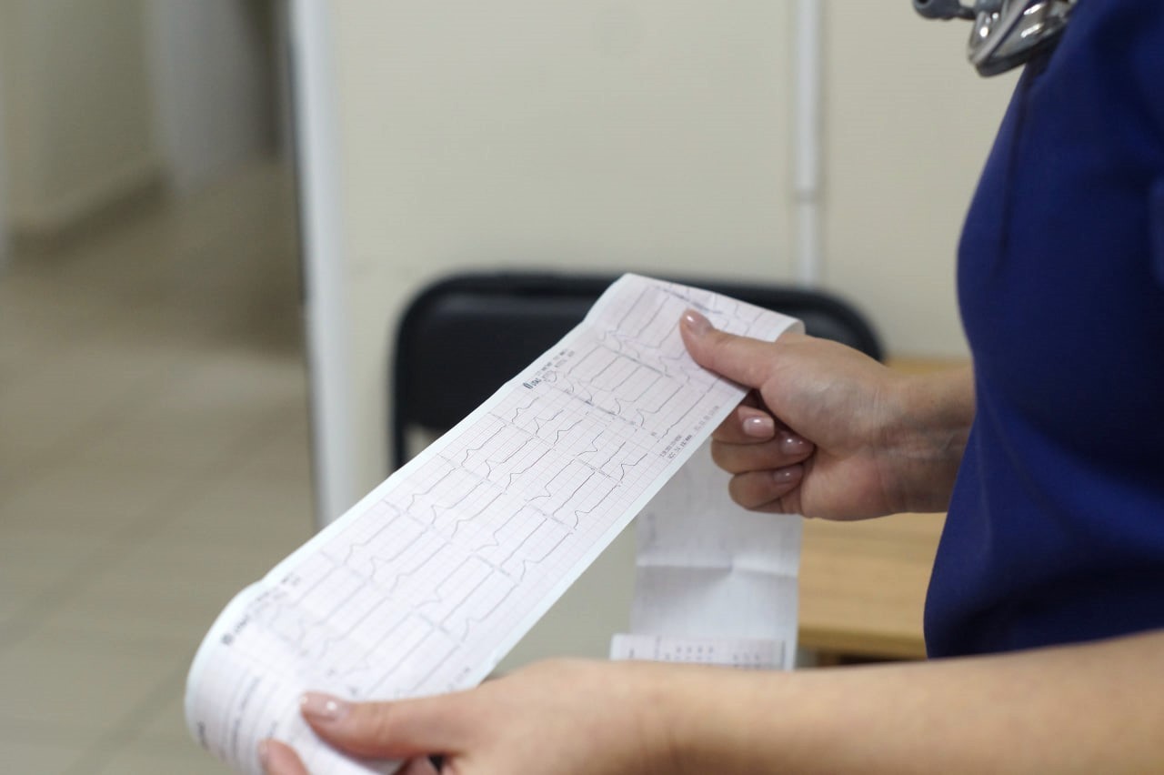 Електрокардіограма (ЕКГ)