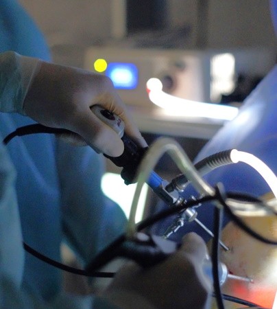 Артроскопія колінного суглоба