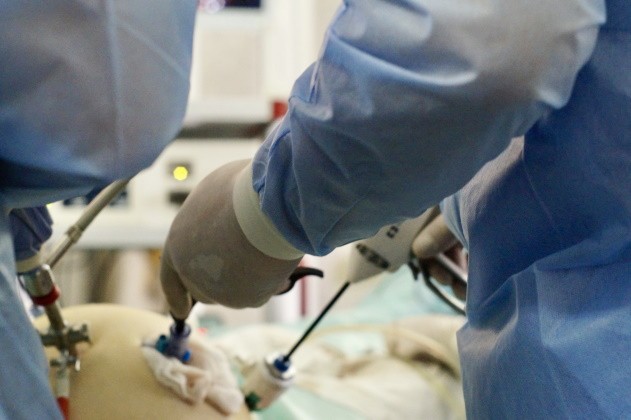 Лапароскопічна резекція