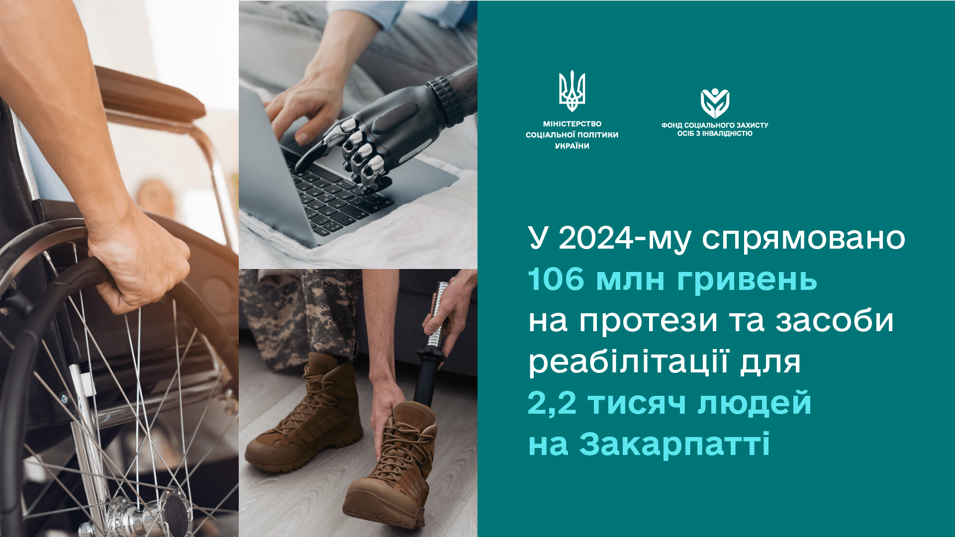 У 2024-му на протезування держава спрямувала понад 5 мільярдів гривень