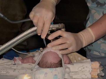 У Лікарні Святого Мартина виконали першу на Закарпатті лазерну операцію при ретинопатії недоношених У Лікарні Святого Мартина виконали першу на Закарпатті лазерну операцію при ретинопатії недоношених