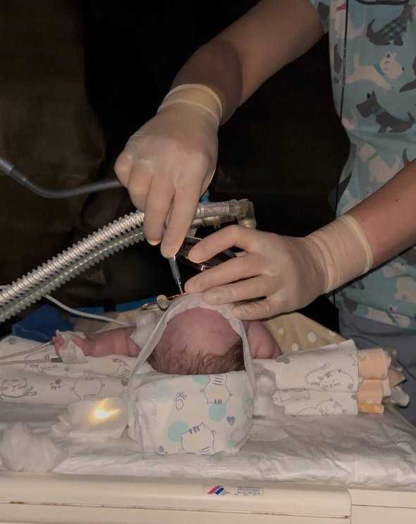 У Лікарні Святого Мартина виконали першу на Закарпатті лазерну операцію при ретинопатії недоношених