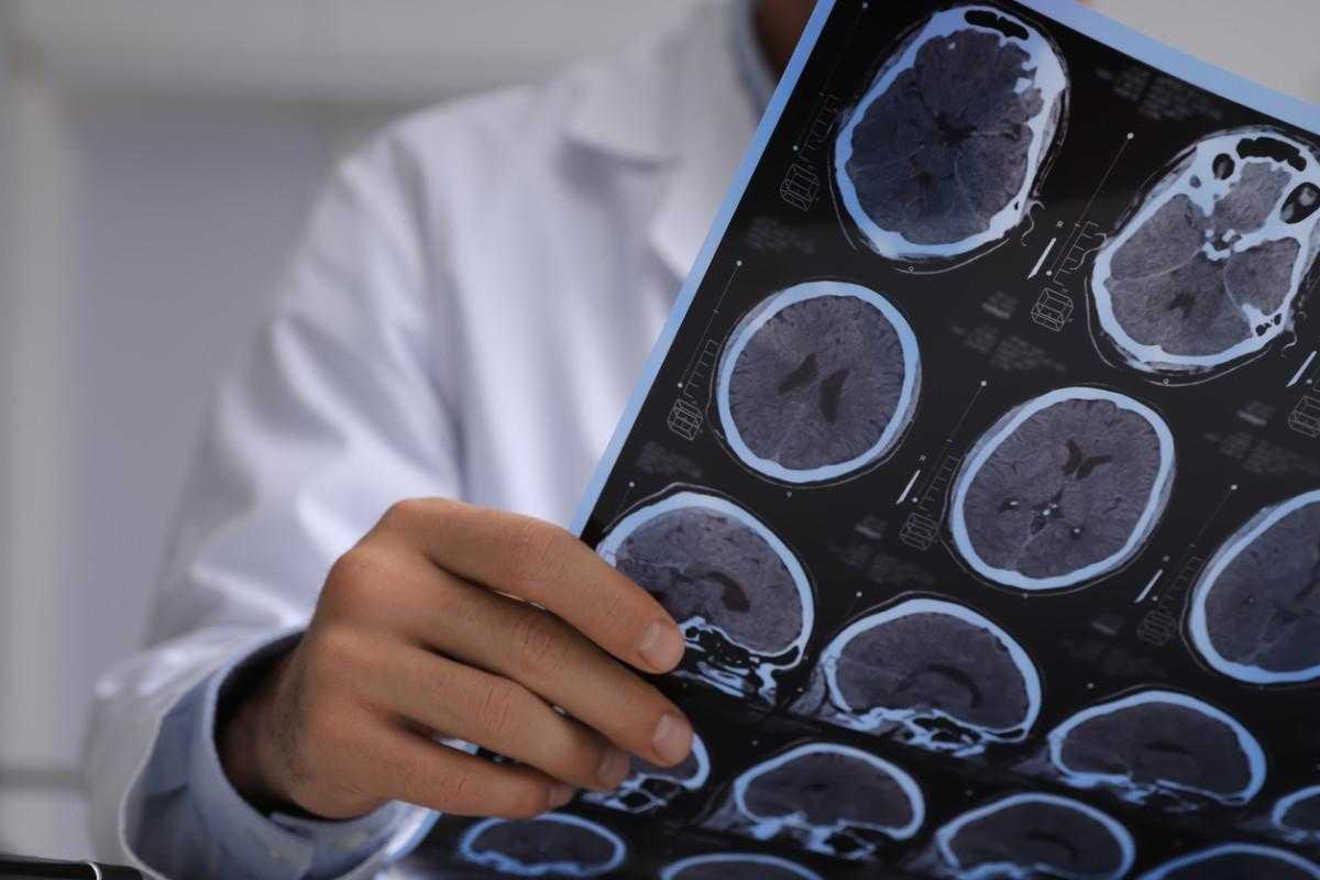 НСЗУ інформує: безоплатне КТ за Програмою медичних гарантій. Що варто знати?